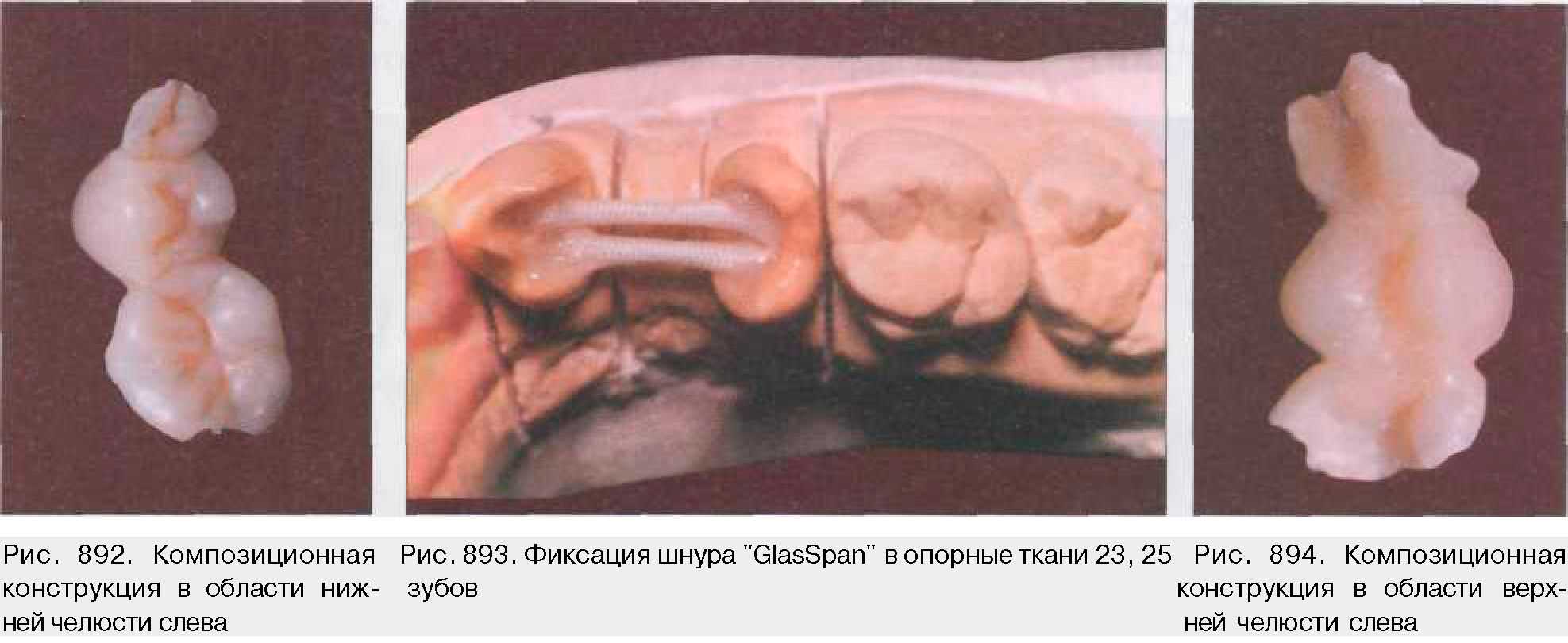 инструкция по применению гласспан