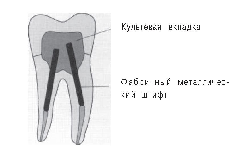 Требования предъявляемые к штифтовому зубу Требования предъявляемые к штифтовому зубу