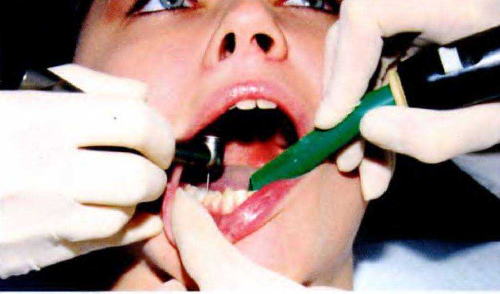 Лечение верхних зубов в каком положении удобнее проводить