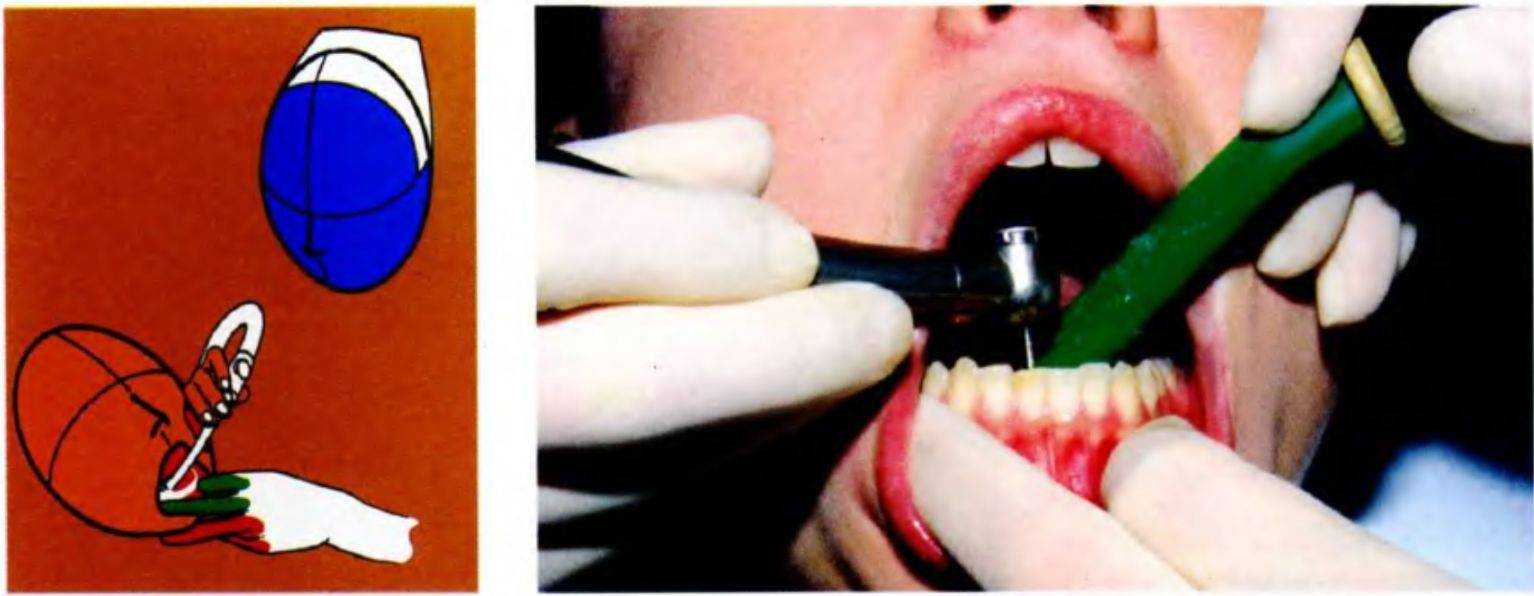 Лечение зубов положение врача