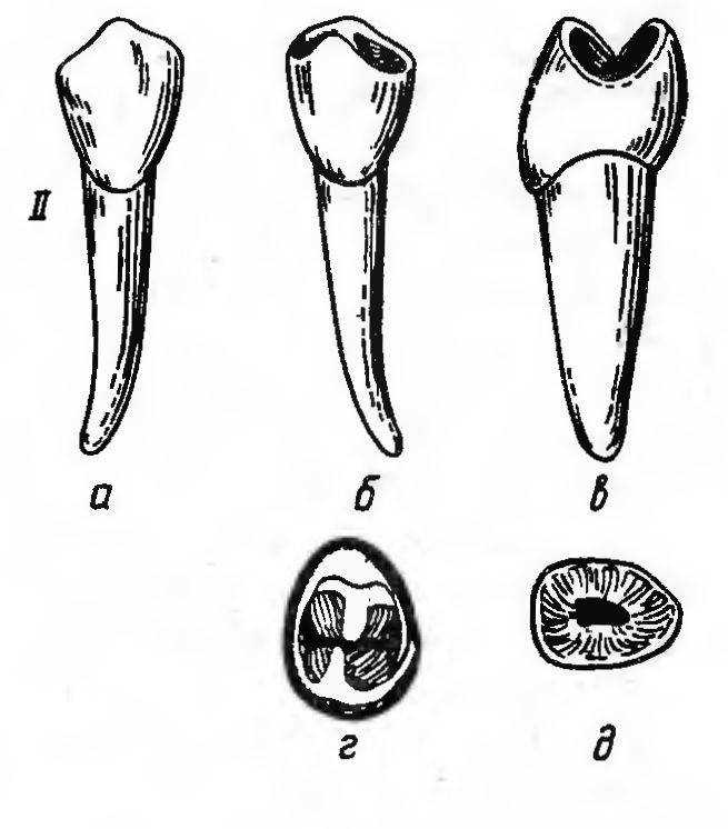 Зуб боковой резец. Клык нижней челюсти анатомия. Боковой резец нижней челюсти анатомия. Анатомия зуба клык верхней челюсти. Нижний премоляр корни.