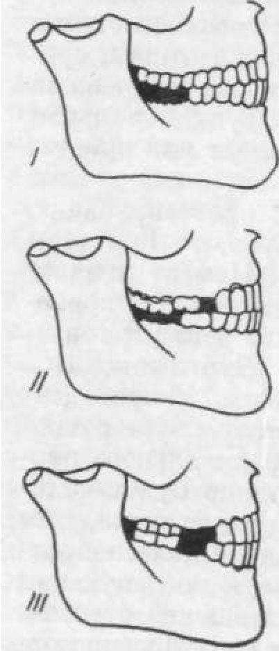 Подготовка полости рта к лечению твердых тканей зубов thumbnail