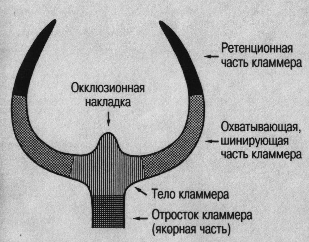 Система нея. Строение кламмера бюгельного протеза. Кламмер Аккера строение. Части опорно удерживающего кламмера. Составные элементы кламмера.