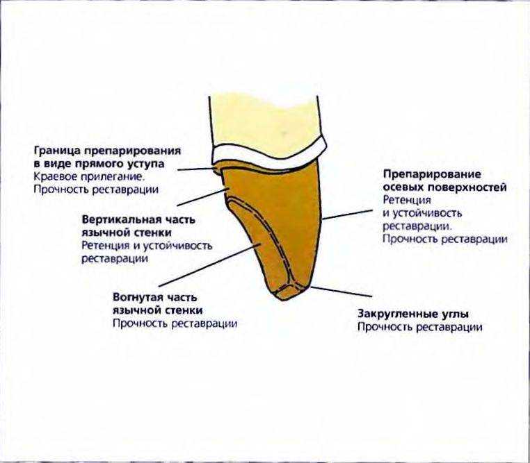 Фото препарирование под штампованную коронку