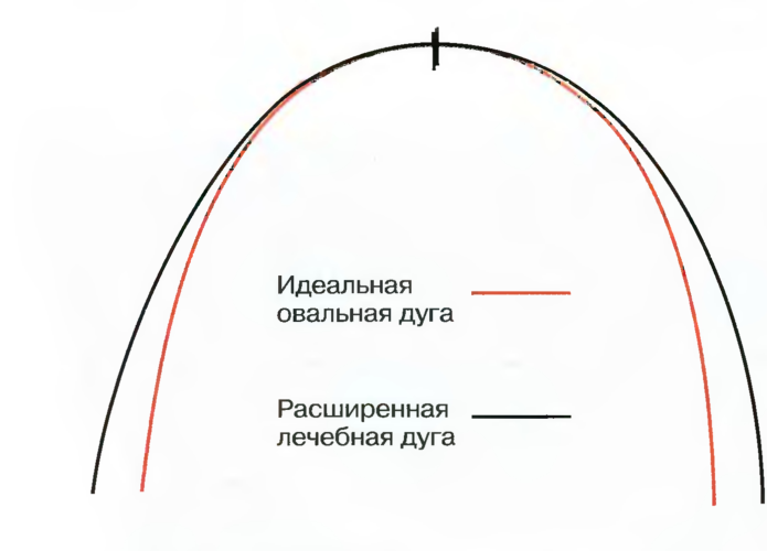 Реферат: Зубна дуга верхньої щелепи