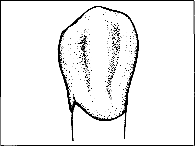 зубы человека резцы клыки схема. строение резца зуба. строение коренного зуба. болит верхний клык. корни 6 зуба верхней челюсти.