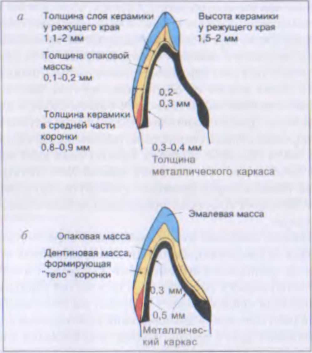 Схема нанесения керамики