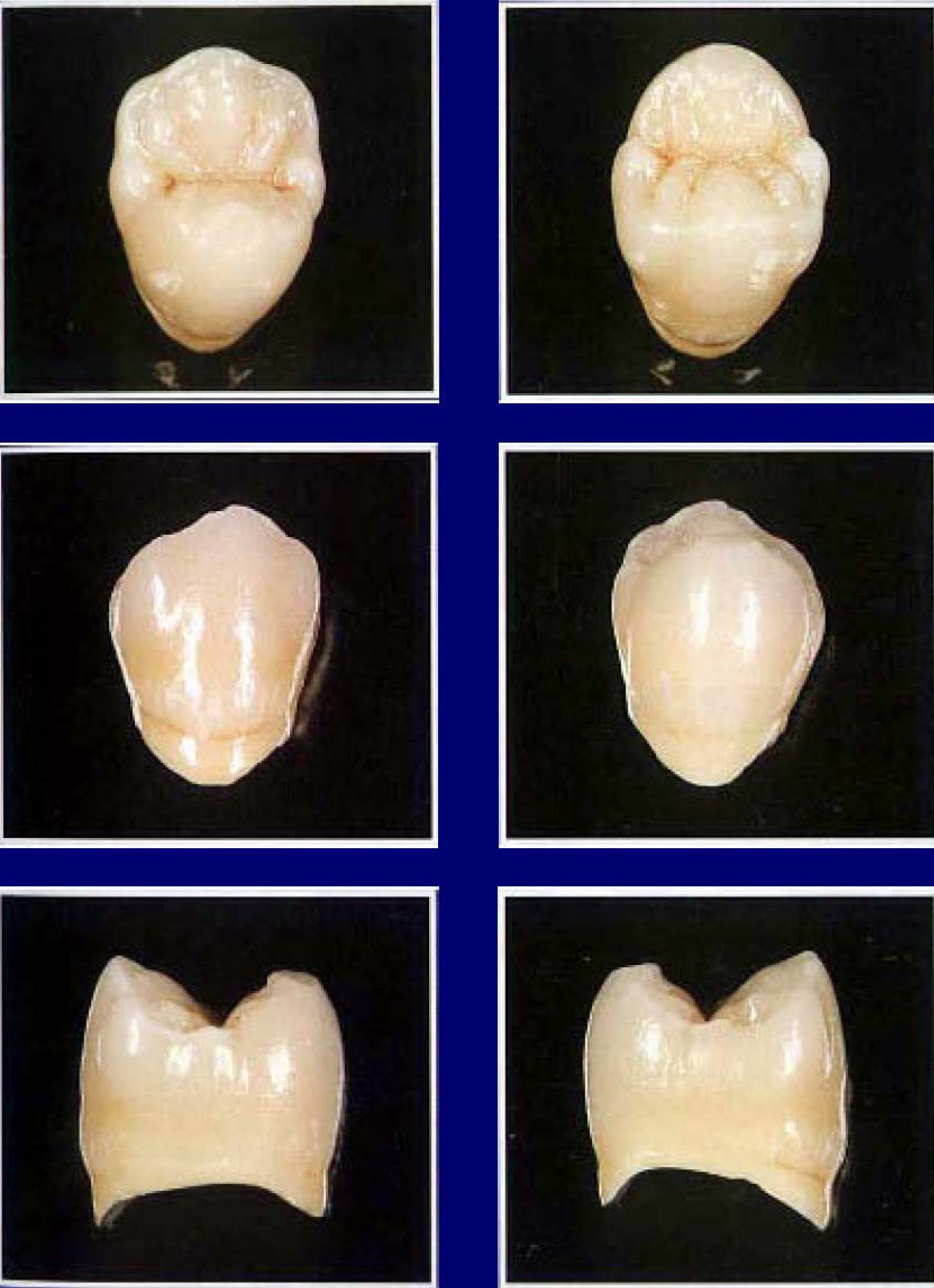 Верхний резец зуб фото