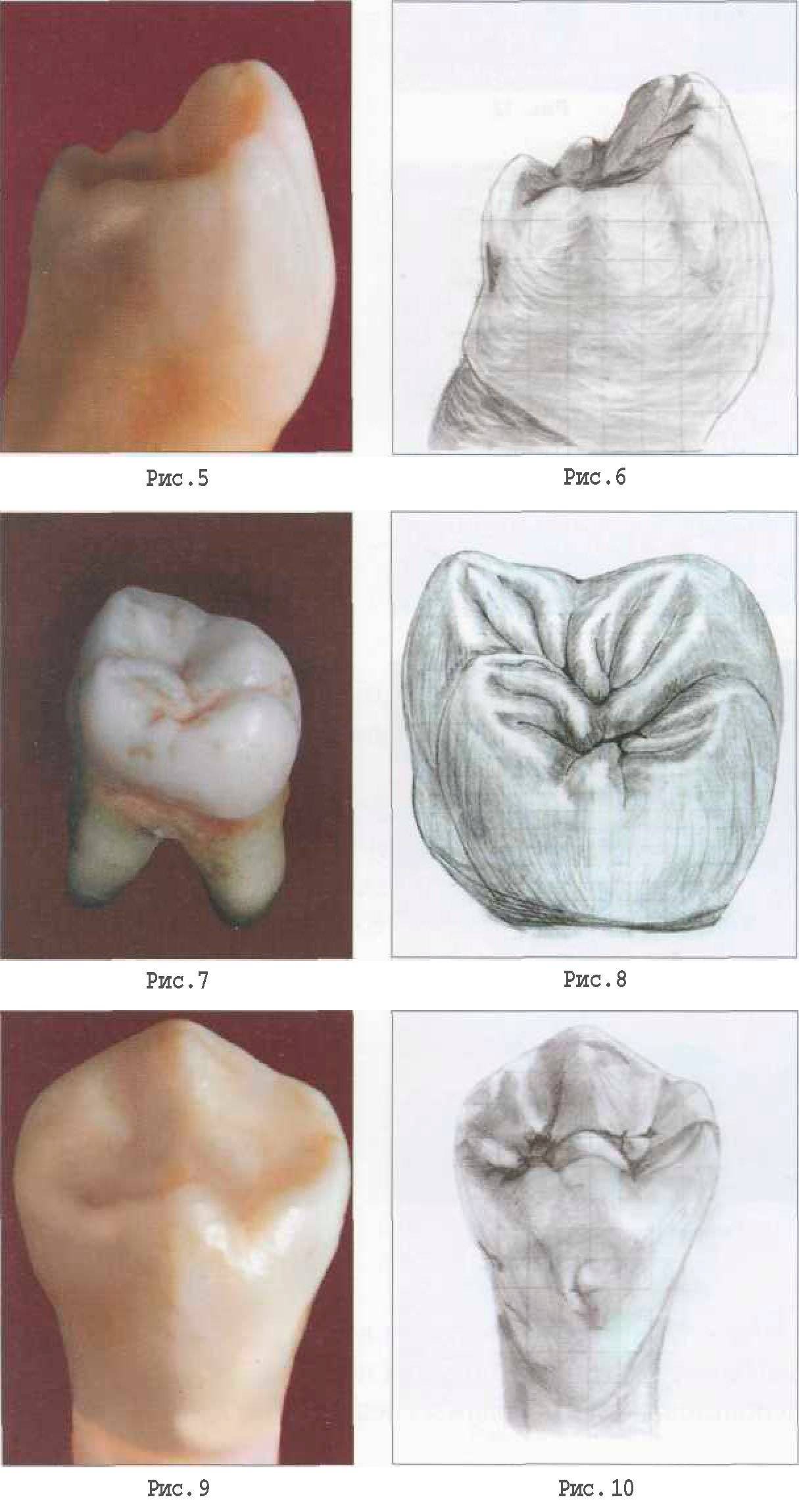 Моделировка 7 зуба нижней челюсти